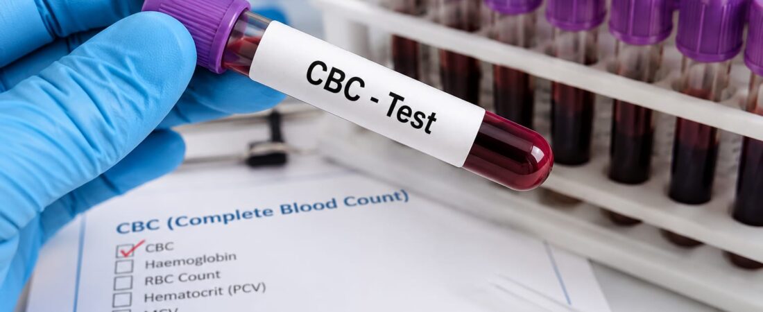 CBC Test क्या है? CBC Test क्यों करवाना चाहिए?