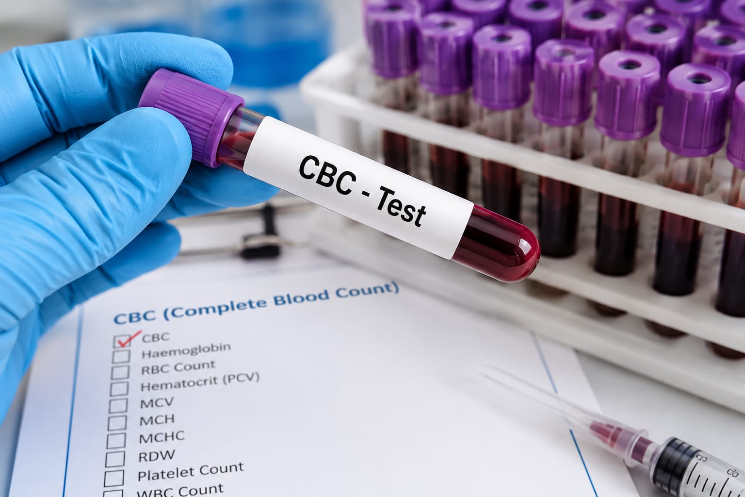 CBC Test क्या है? CBC Test क्यों करवाना चाहिए?